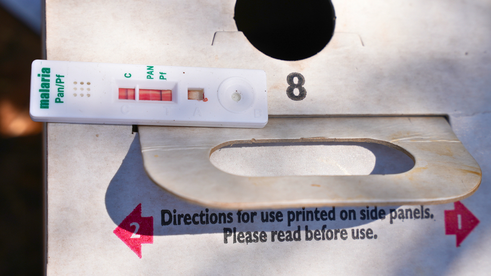 Positive Malaria test