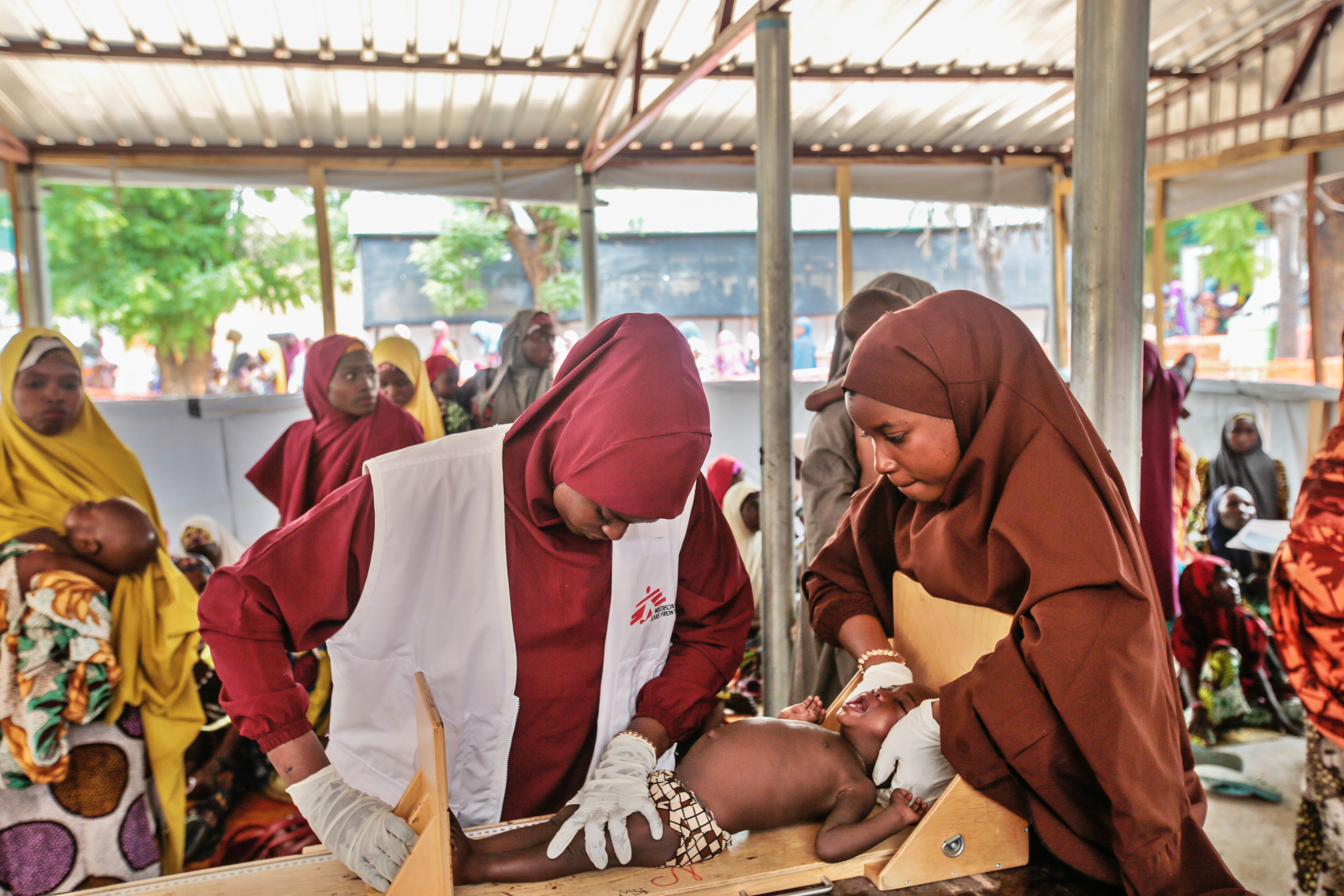 Un enfant est examiné par un membre du personnel MSF à l'ATFC de Kofar Marusa, dans l'État de Katsina, au Nigeria, en juin 2022. Copyright ©George Osodi